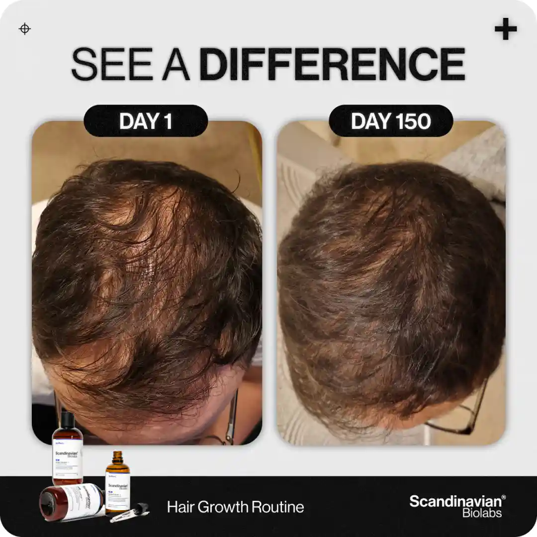 Transformation timeline ad